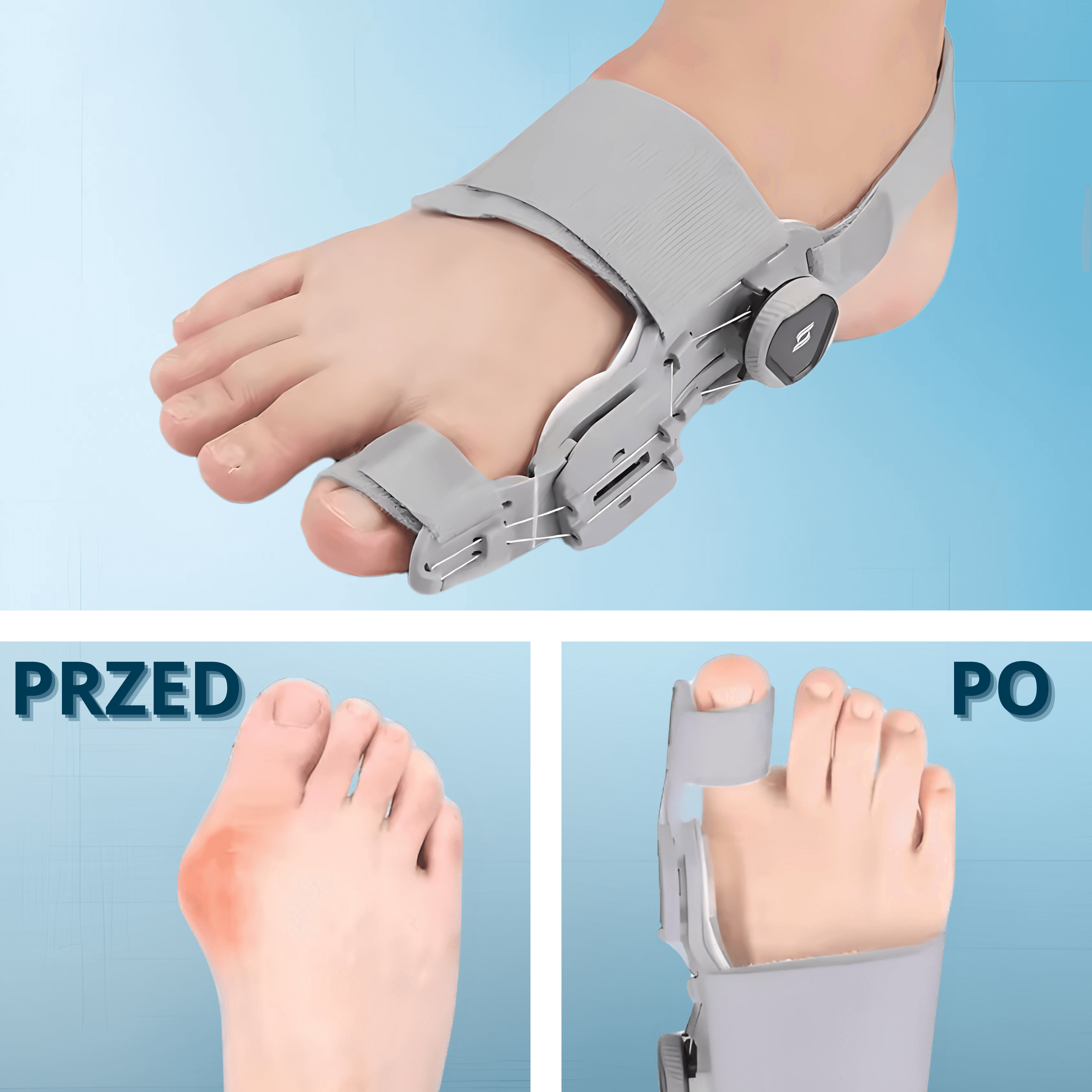 HealuX - Profesjonalny aparat medyczny usuwający haluksy raz na zawsze!  Pasuje na Lewą i Prawą stopę!